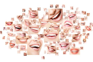 Smiles representing smile restoration work by Trusted Dental Excellence